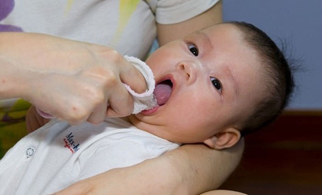 Nghe lời ông bà xưa rơ lưỡi cho con bằng cách này, bố mẹ có thể khiến con bị ngộ độc nguy hiểm - Ảnh 2. Nghe lời ông bà xưa rơ lưỡi cho con bằng cách này, bố mẹ có thể khiến con bị ngộ độc nguy hiểm - Ảnh 2.