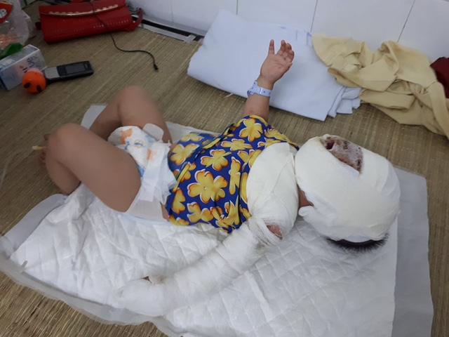  Cháu khóc suốt vì đau. Ảnh PT 