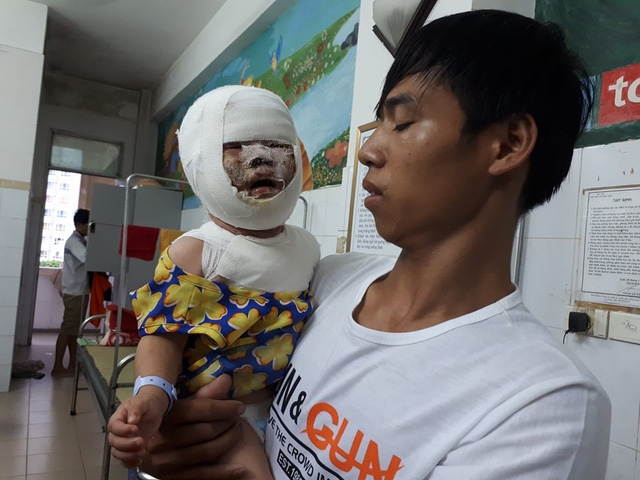  Việc chữa trị cho bé Phượng còn dài mong được sự giúp đỡ của bạn đọc. Ảnh PT 