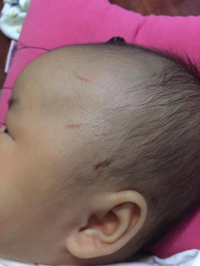 Hà Nội: Mẹ bận trong bếp, khỉ bất ngờ trèo lan can vào nhà cào mặt con gái 2 tháng tuổi - Ảnh 1. Hà Nội: Mẹ bận trong bếp, khỉ bất ngờ trèo lan can vào nhà cào mặt con gái 2 tháng tuổi - Ảnh 1.