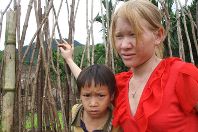 Kỳ lạ chị em người Ca Dong ở Quảng Nam bị xua đuổi, nhà chồng chì chiết vì giống hệt Tây - Ảnh 2.