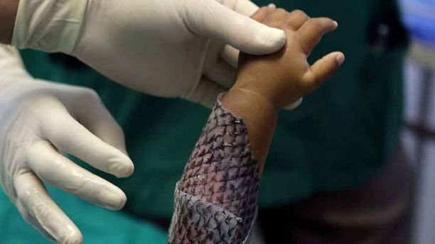 Ai cũng hoảng sợ khi thấy cánh tay da rắn này nhưng sự thật còn bất ngờ hơn - Ảnh 6.