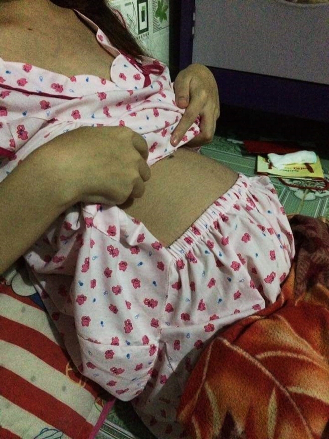 “Giữ mẹ hay giữ con” – câu chuyện xót lòng của thai phụ 20 tuổi đang cận kề án tử - Ảnh 4. “Giữ mẹ hay giữ con” – câu chuyện xót lòng của thai phụ 20 tuổi đang cận kề án tử - Ảnh 4.