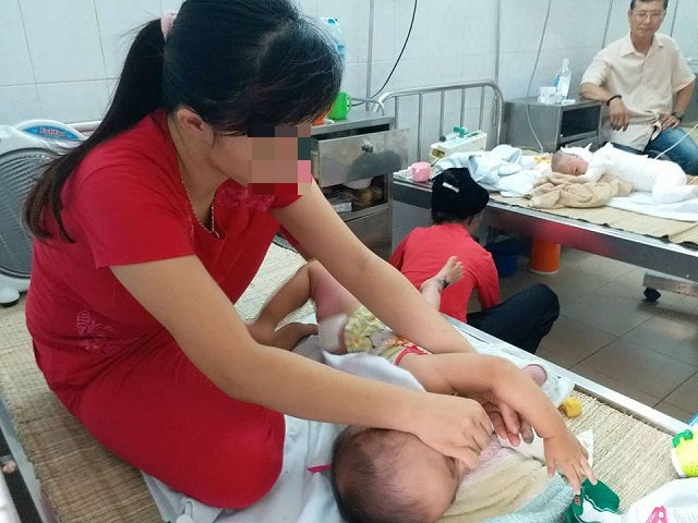 be gai 23 thang tuoi bi bong nang vi ba pha my tom de canh mep ban - 2