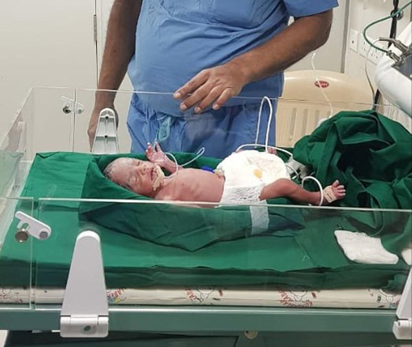 Bé gái châu Á đầu tiên ra đời nhờ cấy ghép tử cung của bà ngoại Bé gái châu Á đầu tiên ra đời nhờ cấy ghép tử cung của bà ngoại