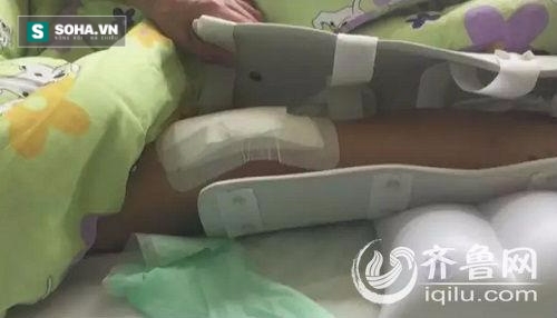 Rúng động vụ học sinh đánh thầy giáo gẫy chân ngay trong trường - Ảnh 1.