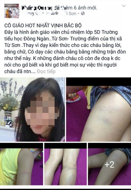 Bắc Ninh: Giáo viên chủ nhiệm đánh học sinh dã man? - Ảnh 1