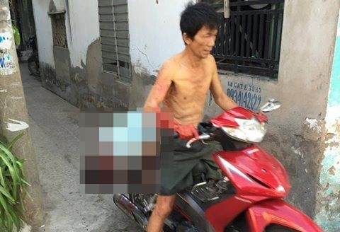 Phut kinh hoang cha cho xac con re den phuong dau thu hinh anh 2
