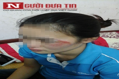 Va chạm giao thông, thai phụ bị gã trai hành hung giữa phố - Ảnh 1