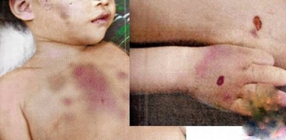 Nghi án bé 2 tuổi bị người giúp việc đánh tử vong vì không chịu ăn