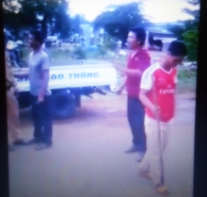 Thanh nien dung dao chem cong an bi thuong hinh anh 1
