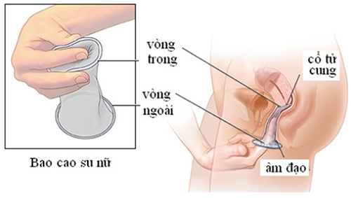 bao-cao-su-nu-bao-boi-bi-lang-quen-trong-viec-ngua-thai-va-benh-tinh-duc