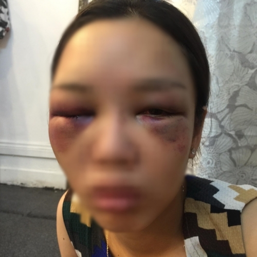 Hotgirl bị người yêu đánh ‘thừa sống thiếu chết’ vì níu kéo tình - Ảnh 2