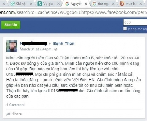Bí mật khủng khiếp lời rao 'từ thiện' 1/3 lá gan giá 1 tỷ - Ảnh 1
