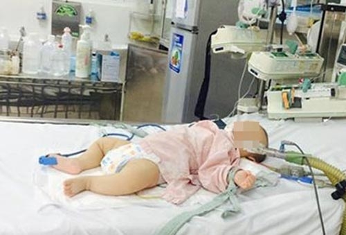  Em bé bị nhiễm độc chì được cấp cứu tại Bệnh viện Bạch Mai. 