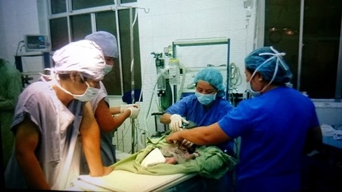 Cứu nhanh, kịp thời trẻ sơ sinh lòi ruột ngoài bụng - ảnh 1