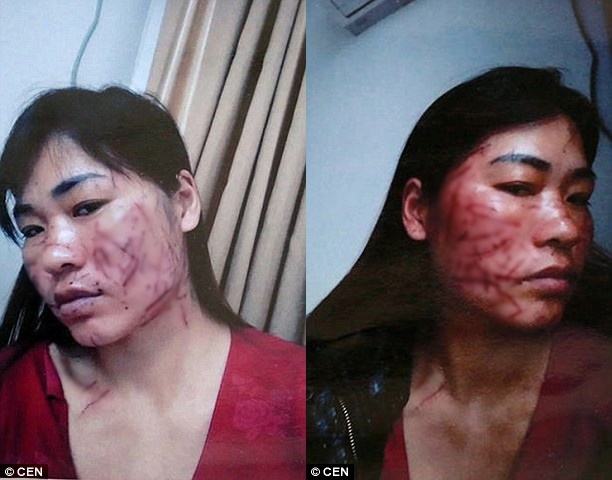 Đòi tiền nuôi con, người phụ nữ bị chồng cũ và nhân tình rạch mặt hàng chục phát - Ảnh 1.
