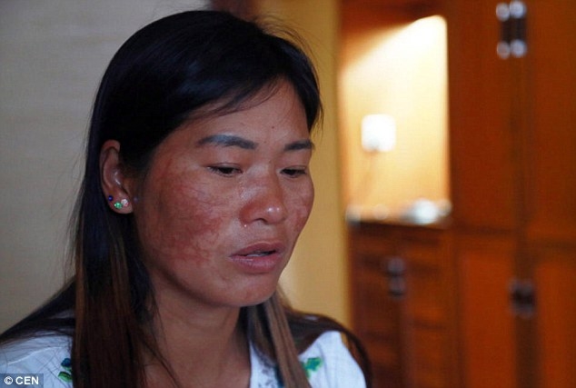 Đòi tiền nuôi con, người phụ nữ bị chồng cũ và nhân tình rạch mặt hàng chục phát - Ảnh 3.