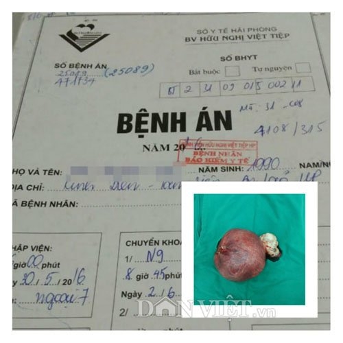 hy huu: benh nhan nam o hai phong co tu cung buong trung hinh anh 1