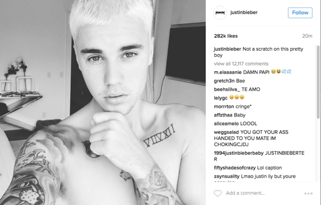 Justin Bieber danh nhau ben ngoai khach san hinh anh 2