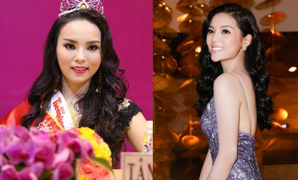 3-hoa-hau-dinh-nghi-an-phau-thuat-thm-my-1