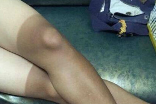 Bi hài những làn da ‘đổi màu’ vì nắng nóng - Ảnh 1