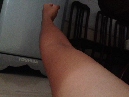 Bi hài những làn da ‘đổi màu’ vì nắng nóng - Ảnh 2