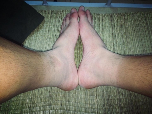 Bi hài những làn da ‘đổi màu’ vì nắng nóng - Ảnh 3