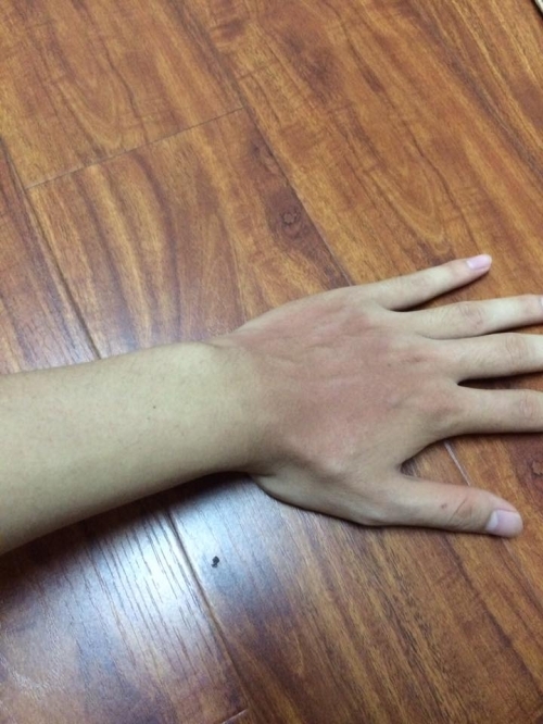 Bi hài những làn da ‘đổi màu’ vì nắng nóng - Ảnh 5