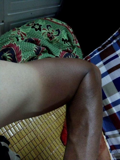 Bi hài những làn da ‘đổi màu’ vì nắng nóng - Ảnh 6