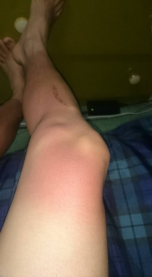 Bi hài những làn da ‘đổi màu’ vì nắng nóng - Ảnh 8