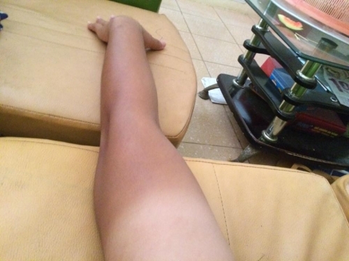 Bi hài những làn da ‘đổi màu’ vì nắng nóng - Ảnh 9