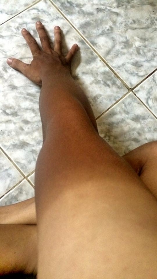 Bi hài những làn da ‘đổi màu’ vì nắng nóng - Ảnh 10