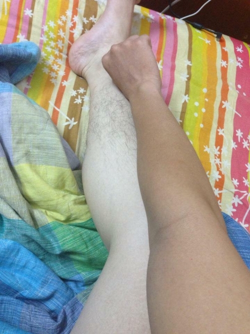 Bi hài những làn da ‘đổi màu’ vì nắng nóng - Ảnh 11