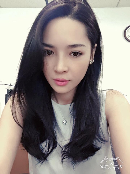 cuoc doi sang trang cua co gai lot xac nho phau thuat tham my - 6