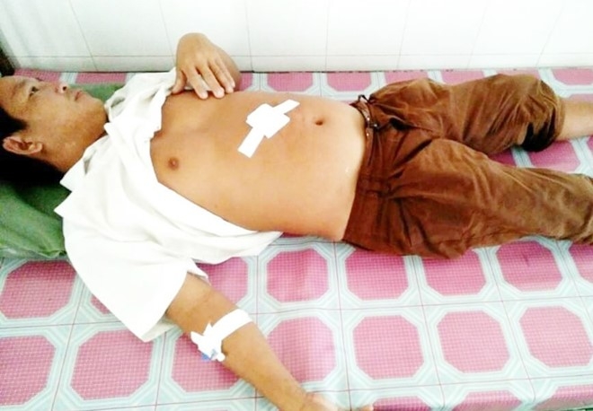 Bi dam trong thuong khi ngan con do chem hang xom hinh anh 1