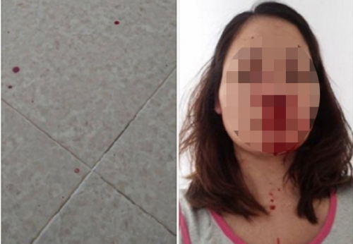 Người vợ 18 năm bị chồng đánh đập vùng lên khi được con 'thức tỉnh' - Ảnh 1