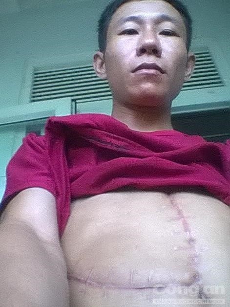 Dan trau hoang dien cuong tan cong nguoi hinh anh 2