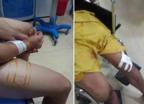 Lý lịch 'đen' của 9x đâm 5 người thương vong trong đám cưới - Ảnh 2