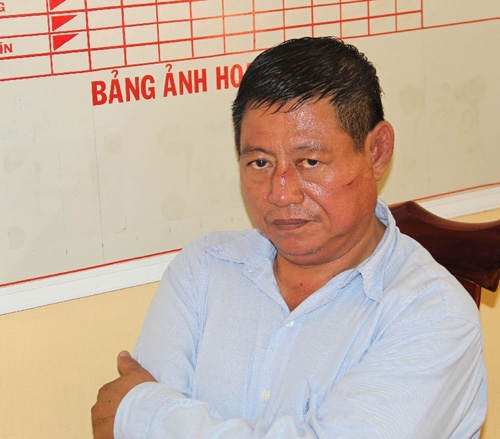 giết người, trung tá công an