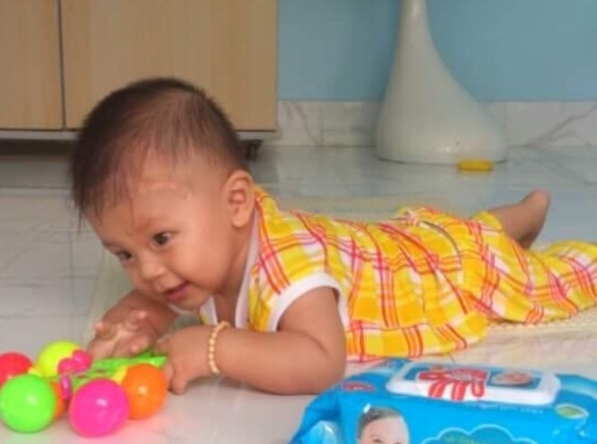 Cậu bé bị đâm xuyên não khỏe mạnh đón thôi nôi
