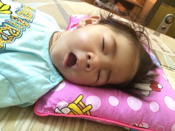 Bé gái 14 tháng tuổi nặng 3,5kg đang tập kích thích cơ và đã tăng lên 6,5kg