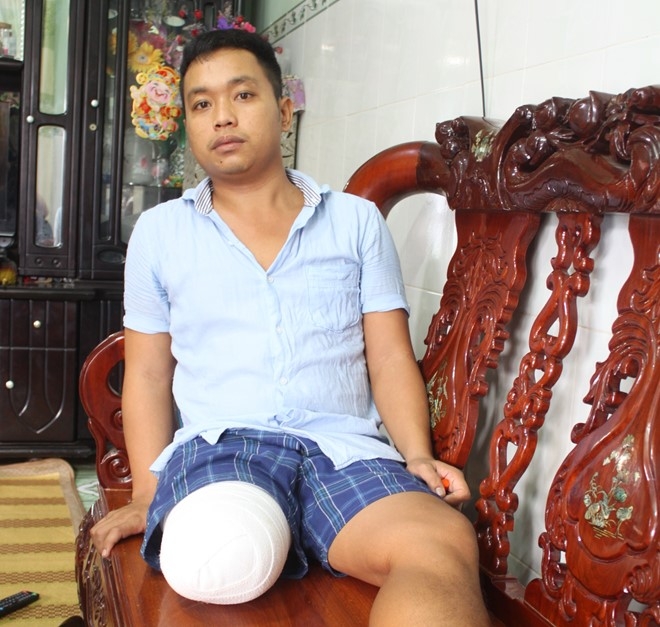 Benh nhan bi cua chan o Sai Gon vi bac si thieu kinh nghiem hinh anh 1