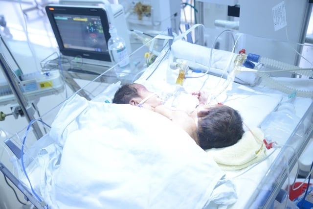 Mặc dù đã được các bác sĩ tận tình chăm sóc nhưng các cháu vẫn không qua khỏi. Ảnh: P.T
