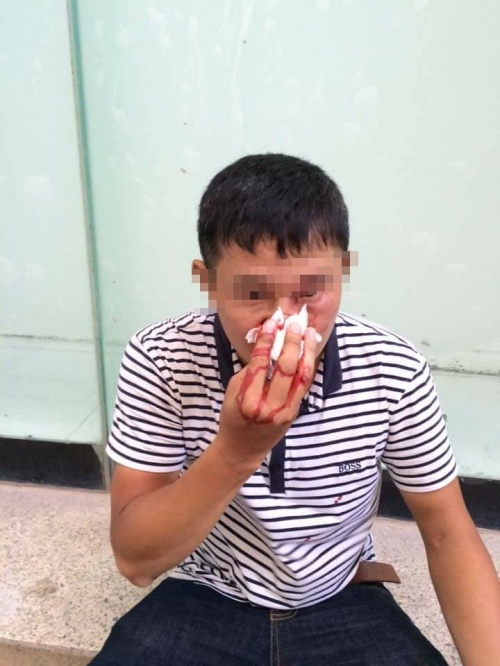 'Đại gia' quỵt 30 ngàn tiền giao hàng và đánh shipper gãy mũi - Ảnh 2