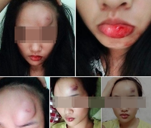 cô gái trẻ, bị đánh, bố chồng đánh con dâu, bầm dập, bạo hành
