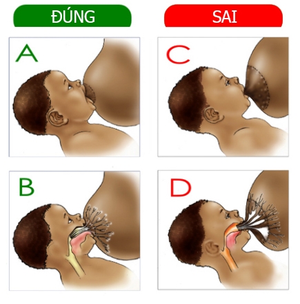 tu-the-dung-va-sai-khi-cho-tre-bu-1