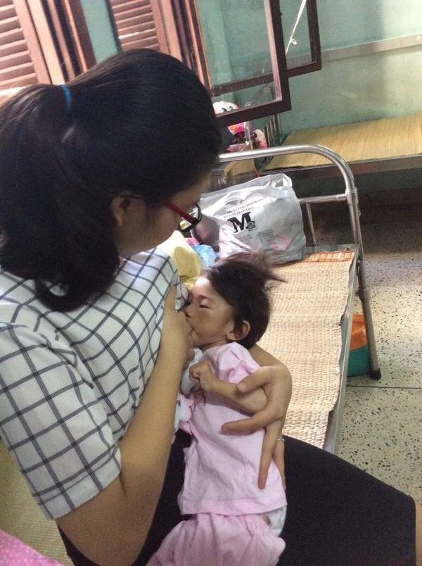 Hành trình kỳ diệu thay da đổi thịt của bé gái 14 tháng tuổi chỉ nặng 3,5kg