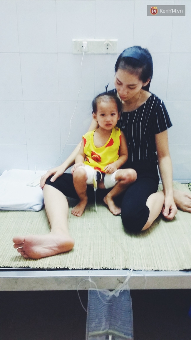 Sức khỏe cháu bé bị cả nồi canh dội vào người đang tiến triển tốt - Ảnh 2.