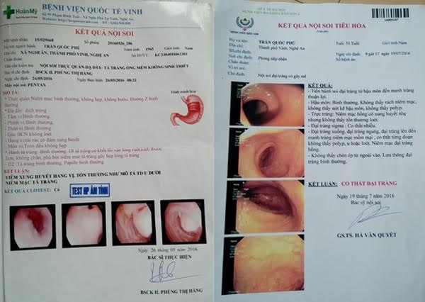 GS Hà Văn Quyết, u trực tràng, cắt khối u